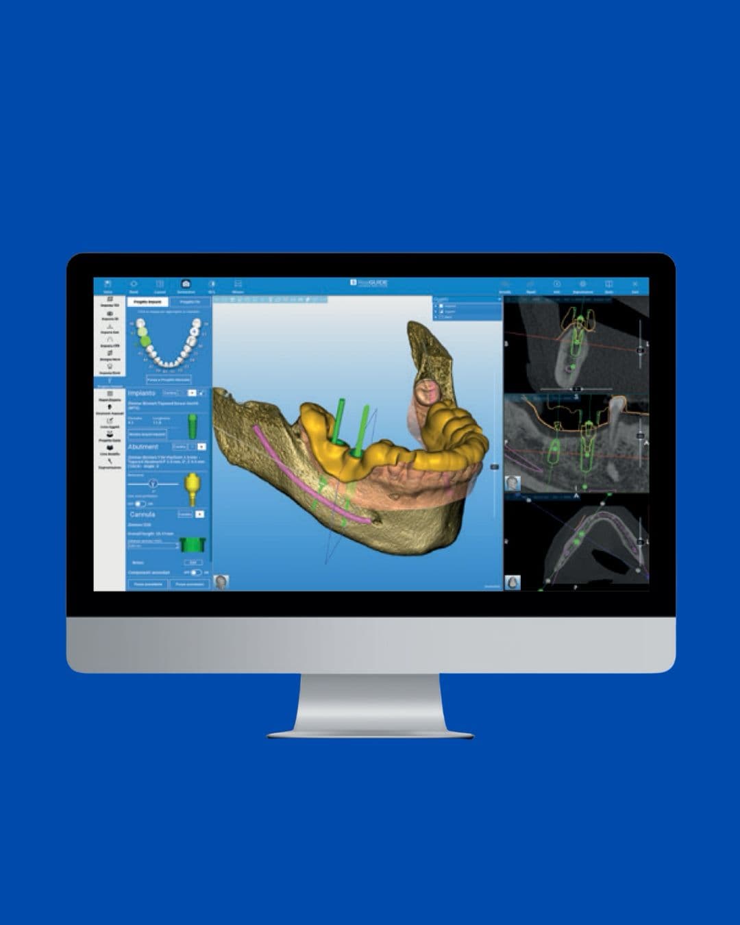 Realguide software