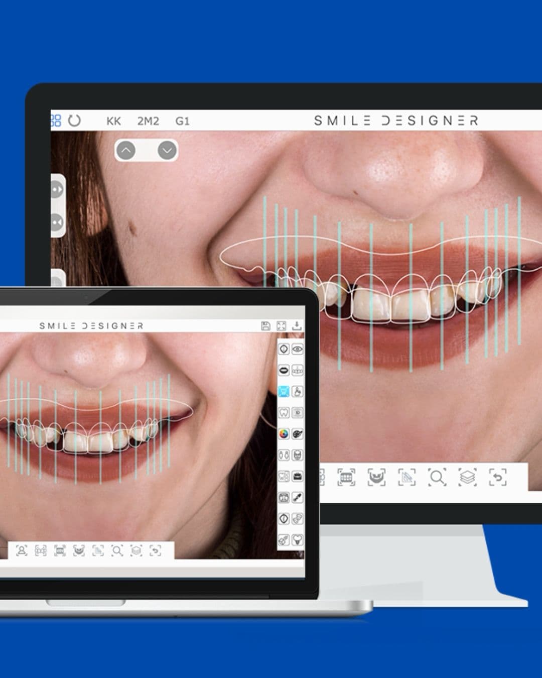 Smile designing software