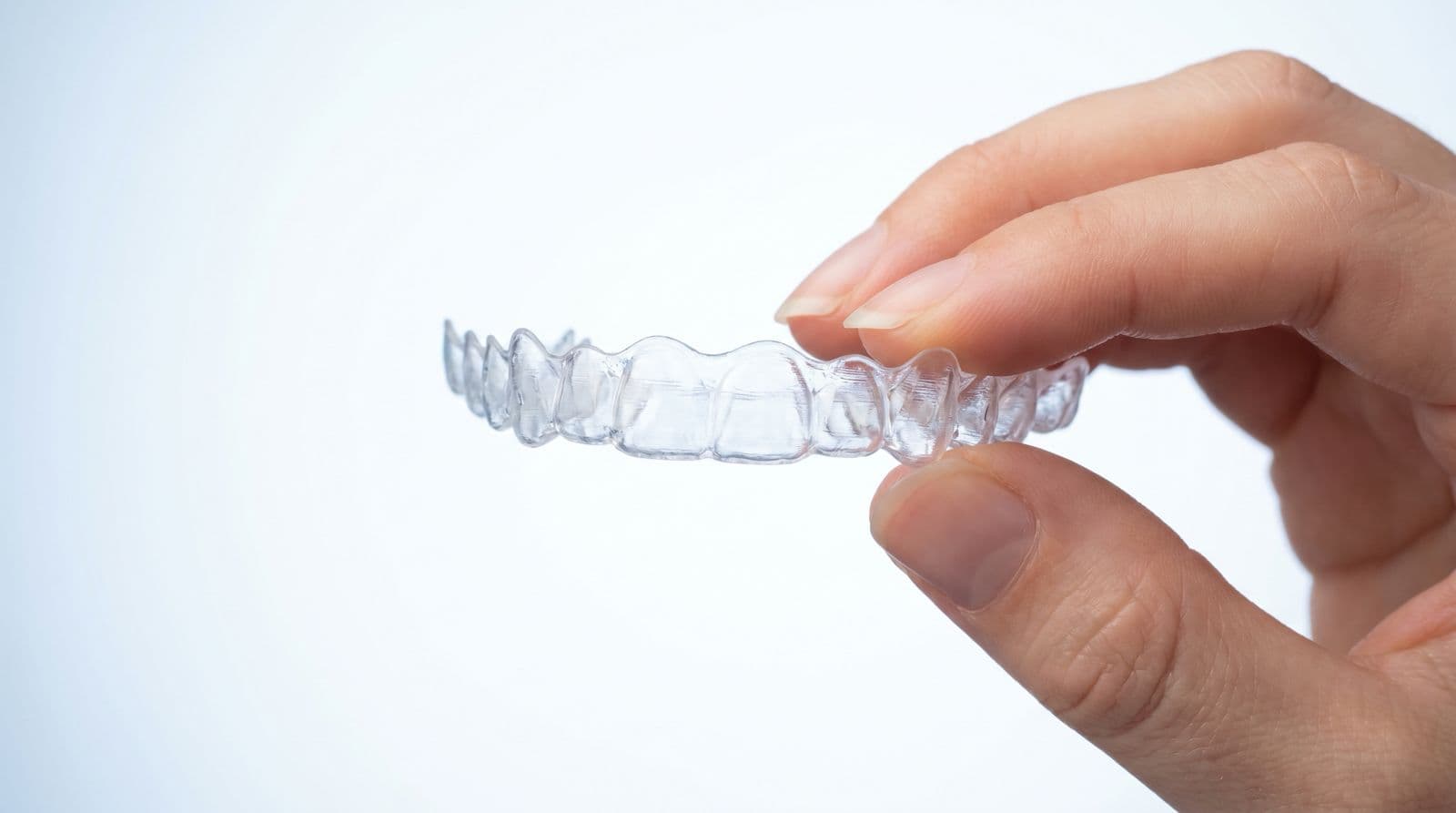 iTero Lumina 3D Smile Simulation