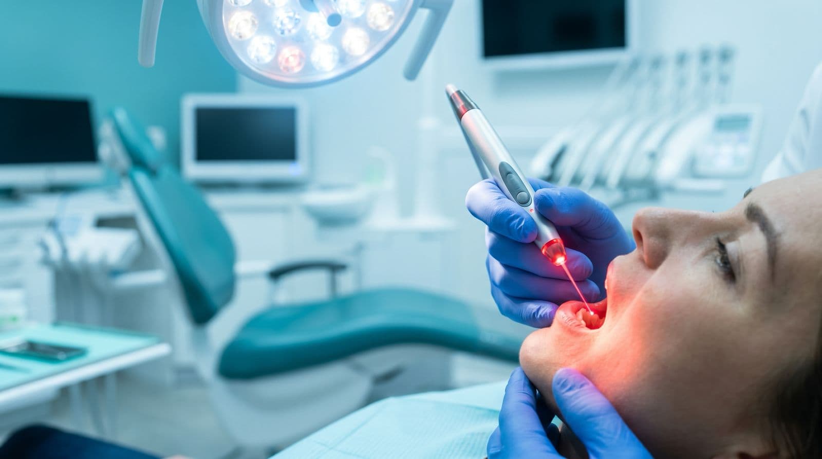 Dentsply SiroLaser Blue Soft Tissue Procedure
