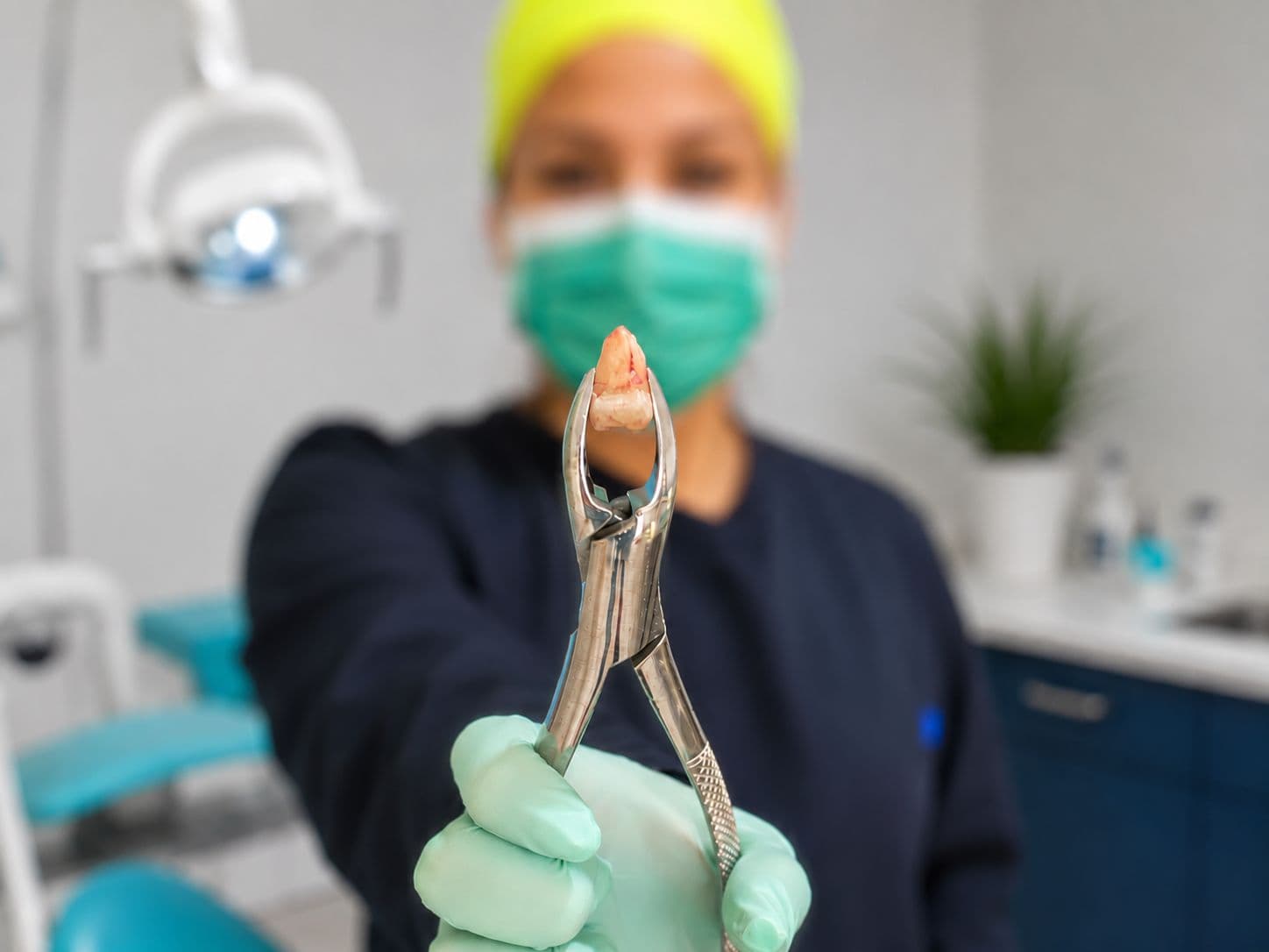 Tooth Extraction Procedure at Maxface Dental Clinic Bangalore