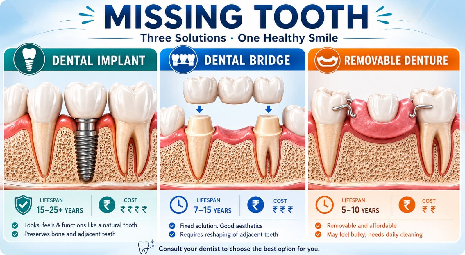Dental Implants vs Bridges vs Dentures: Best Choice Guide